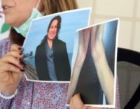 Turquia prende política curda sujeita a tortura durante detenção