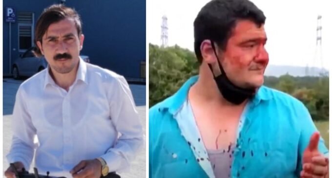 Ataques a jornalistas na Turquia são muito comuns, as autoridades devem levar esses casos a sério